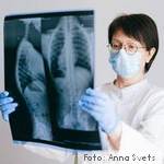 La COVID-19 y las enfermedades no transmisibles, la tormenta perfecta – informe de la OMS y la ONU