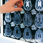 Análisis de la conectividad dinámica funcional mediante fMRI en el envejecimiento saludable