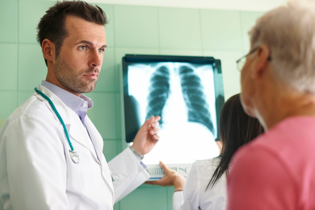 cáncer de pulmón