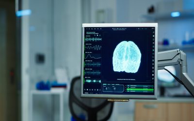 La carga sanitaria silenciosa de las enfermedades neurológicas