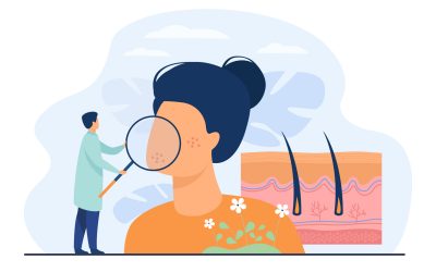 La necesidad de incluir la salud mental en el abordaje integral de la psoriasis