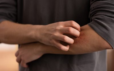 Día Mundial de la Dermatitis Atópica 2026: visibilizar una carga que va más allá de la piel